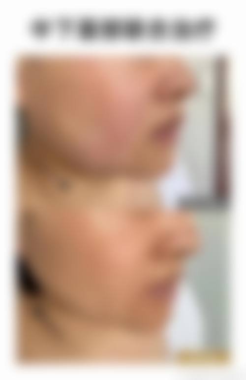 深圳南西子医疗美容整形门诊部更擅长什么