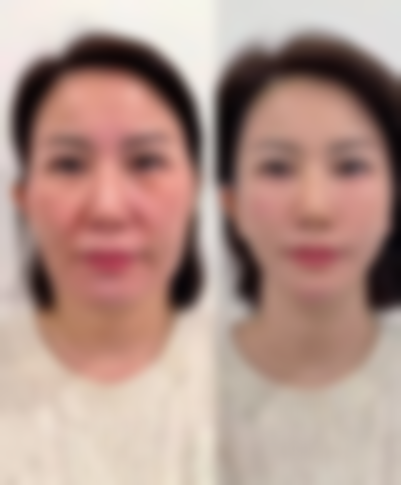 南医 大友谊整形扬州医疗美容门诊部更擅长什么