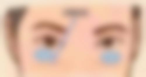 昆明亿美倩整形医院怎么样——口碑评价