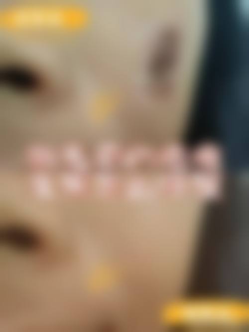 韩国七老医院价格表