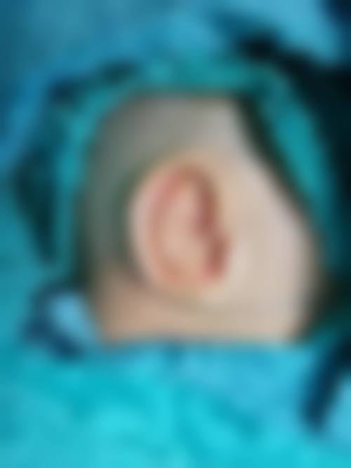 任加伟医生项目优势