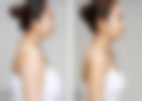 眉山熙芝医疗美容诊所更擅长什么手术