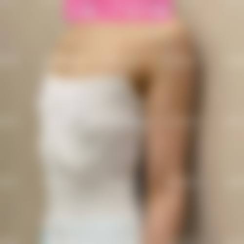 莆田涵江医院整形美容科怎么样，口碑评价如何？