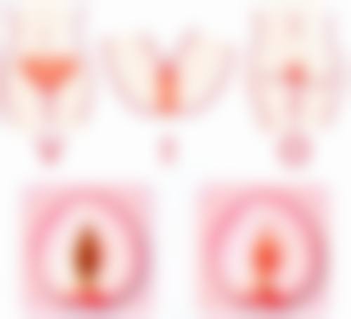 韩国BR贝乐居私密整形医院真实患者口碑评价