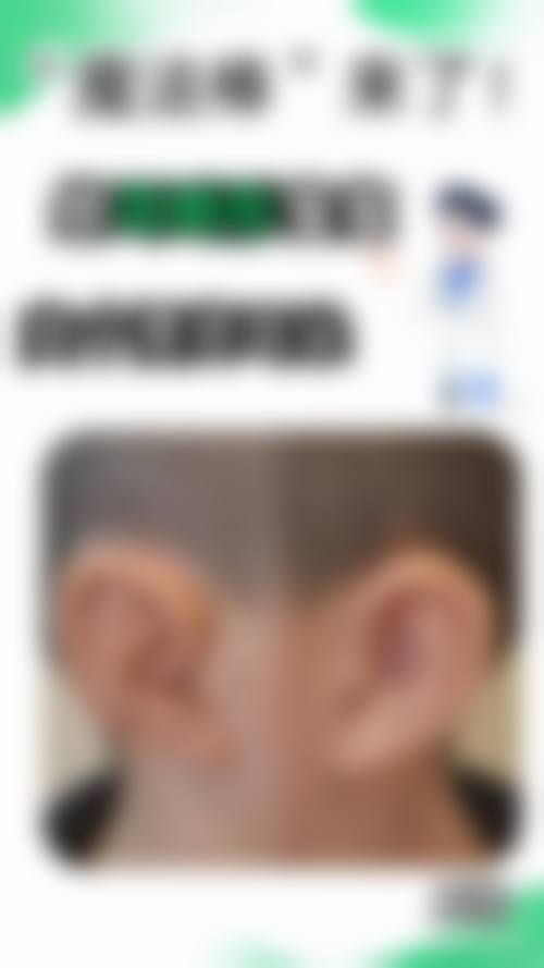 余昌胜医生做手术价格