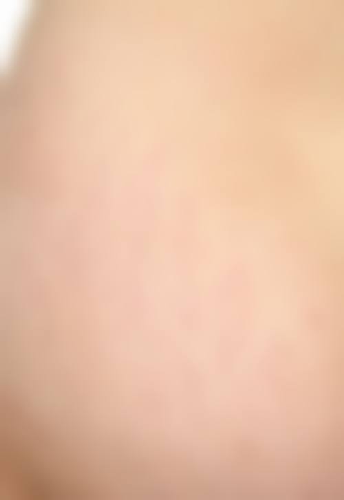 娜人皮肤科怎么样：上班时间与地址