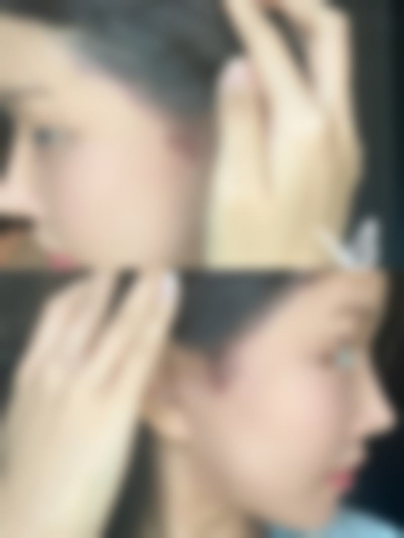 张文丽医生简介做手术价格