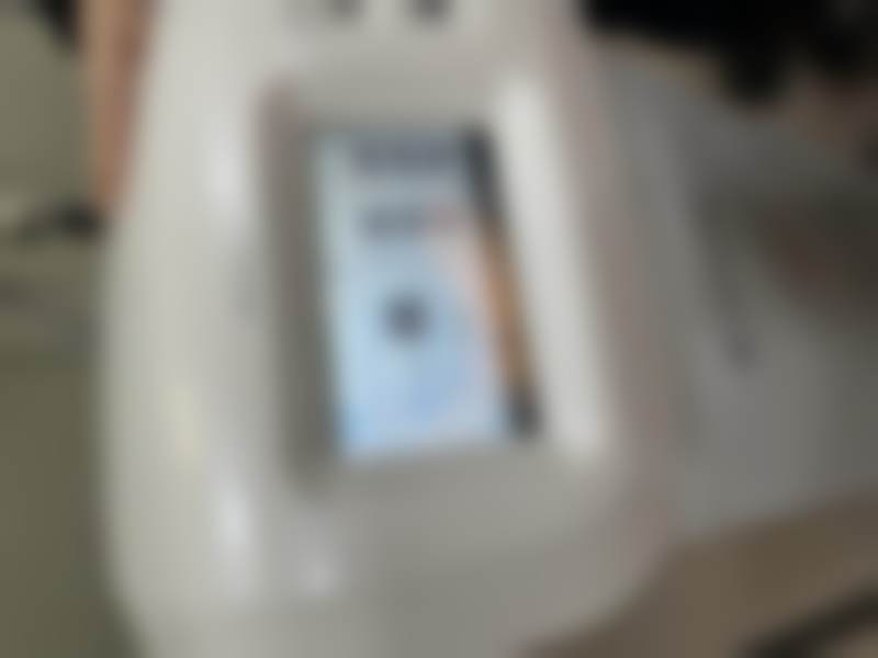 S女性医院李惠妍私密激光美白项目