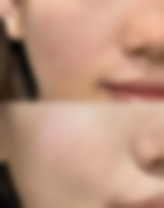 甄琳医生怎么挂号