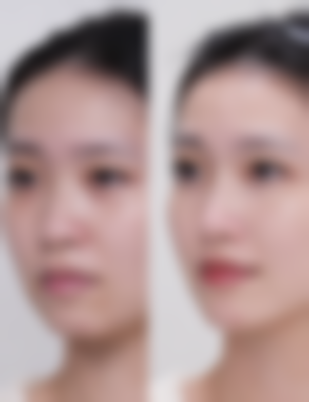 台州悠美丽思医疗美容门诊部价格表