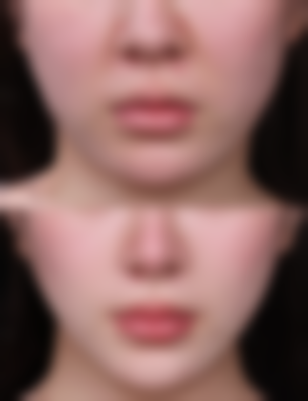 甄琳医生项目优势