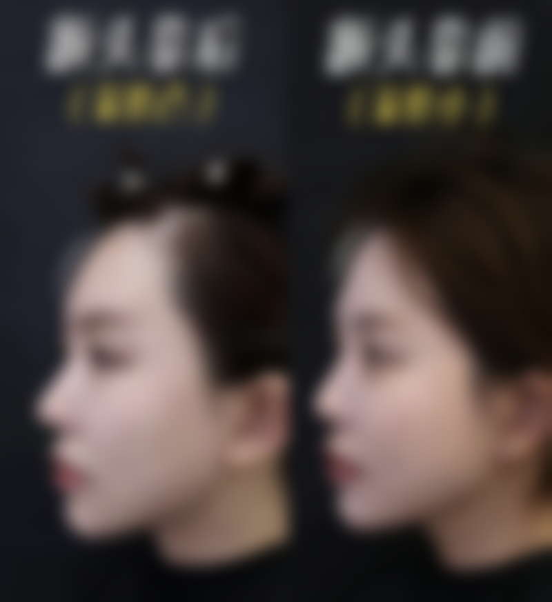 宿迁市人民医院烧伤整形美容科口碑好不好？附真实患者口碑评价