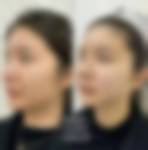 北京汇美医疗美容的高海燕医生怎么样