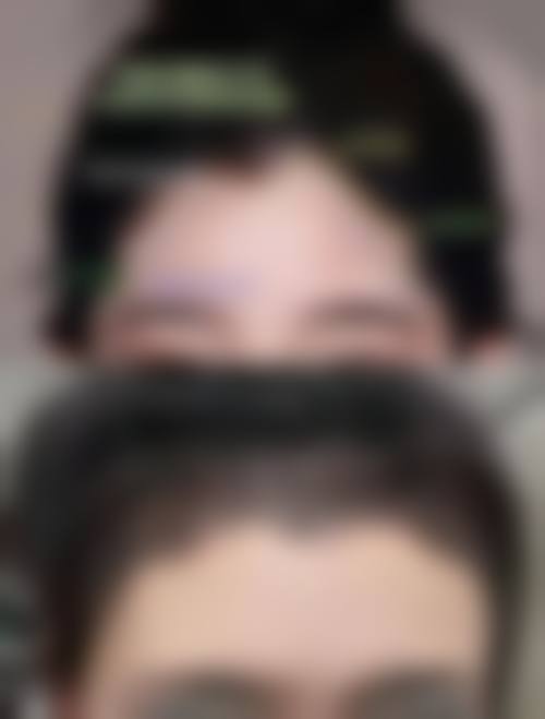 七、重庆原辰整形美容医院怎么样之口碑好不好？附真实患者口碑评价