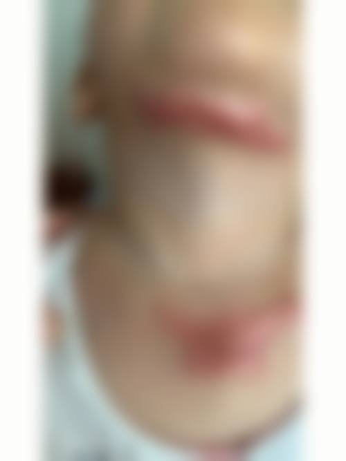 徐普庆医生做手术价格范围