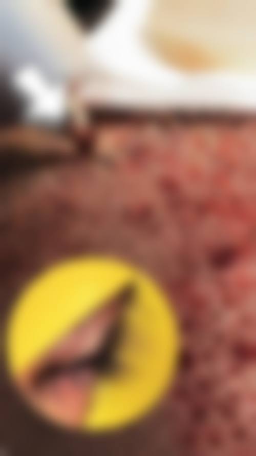 深圳盛美佳医疗美容整形医院口碑好不好？附真实患者口碑评价