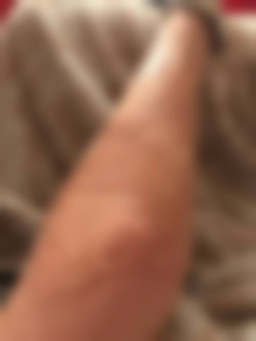 武汉民生五官医院整形科怎么样，口碑评价如何？