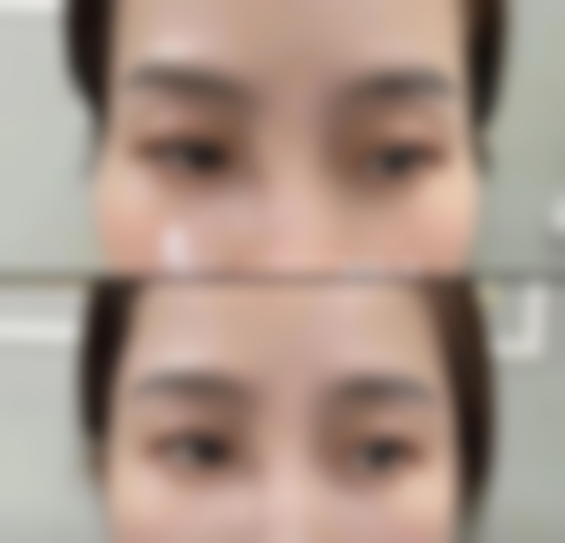 邵丽娜医生简介做手术价格