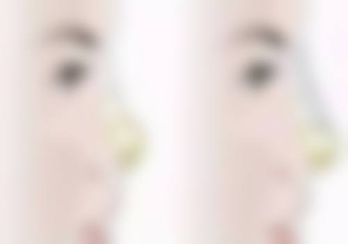 邵军 医生简介项目优势