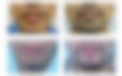 莱阳懿美整形医院怎么样，口碑评价如何？