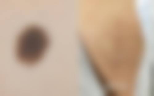 株洲爱思特医疗美容医院口碑评价