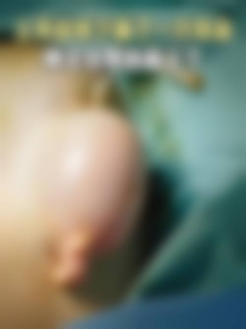 株洲爱思特医疗美容医院项目特色