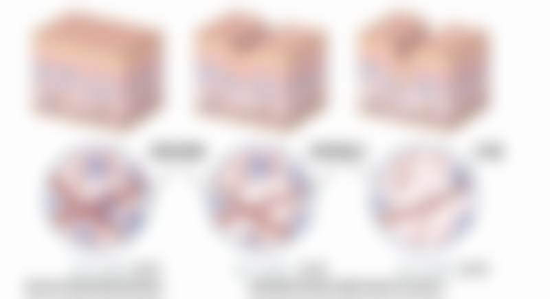 8000元起享杯状耳矫正，广州高尚医学美容中 心预约方式