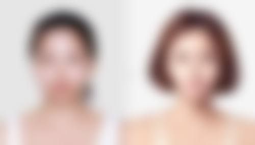 周晶蓉医生简介做手术价格