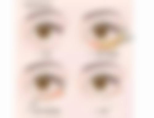 周晶蓉医生简介口碑如何