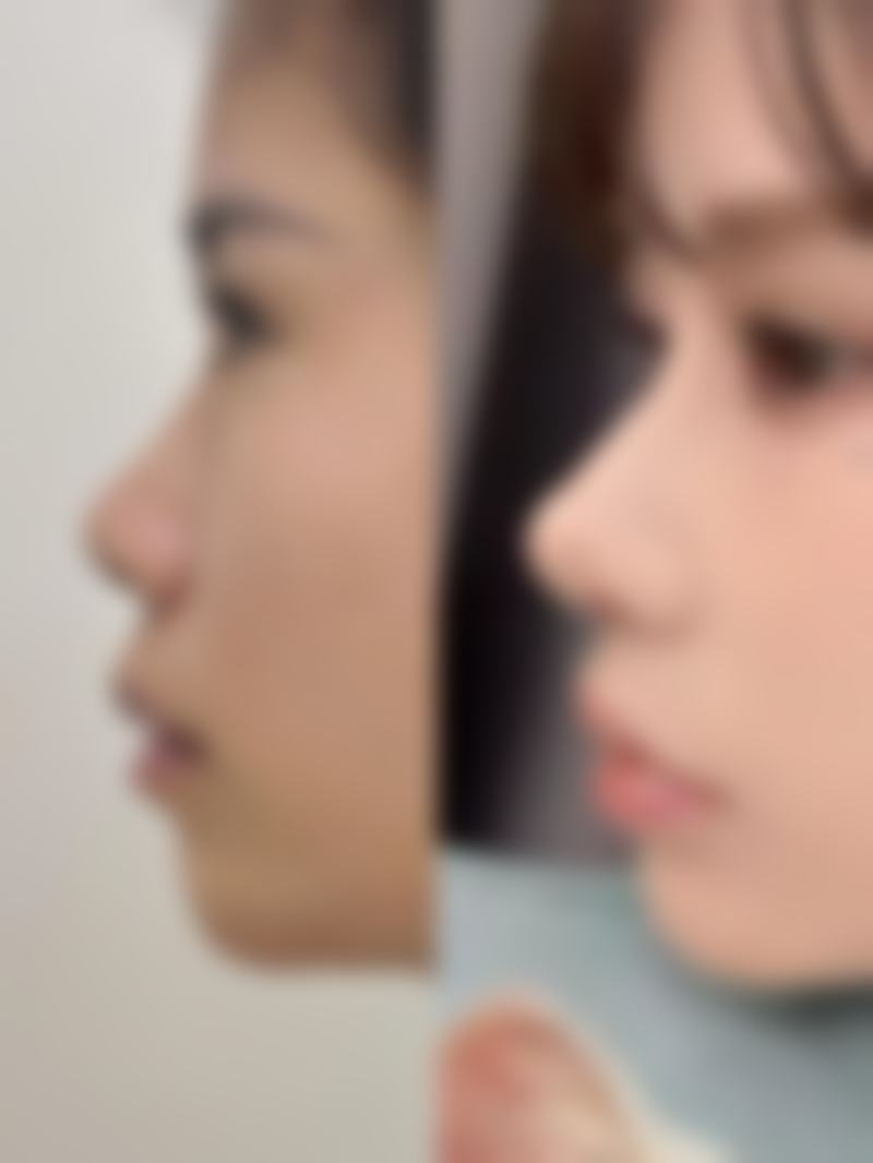 长沙艾依美整形医院口碑评价