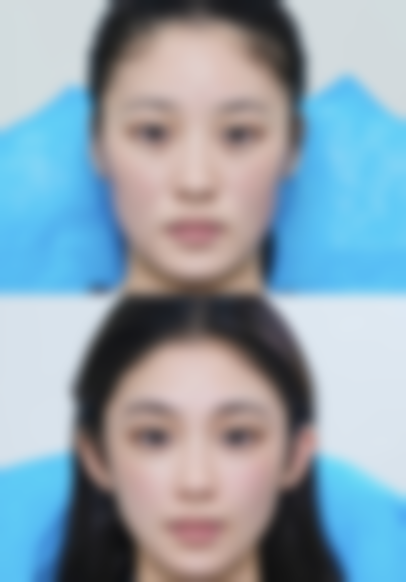 长沙艾依美整形医院口碑好不好