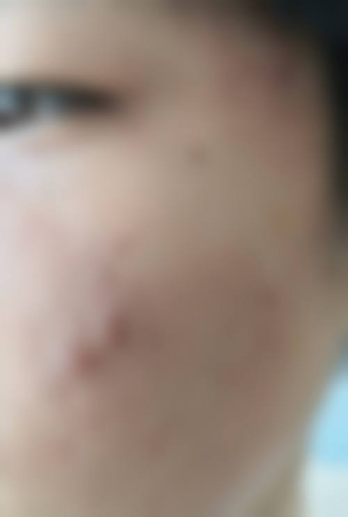 三、荆州阿芙罗整形医院怎么样——口碑评价如何