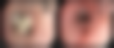 武汉艾美医疗美容医院口碑好不好？附真实患者口碑评价