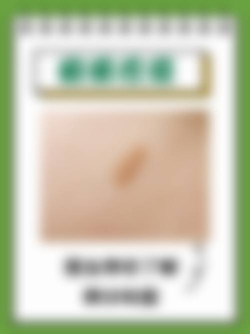 四、荆州阿芙罗整形医院怎么样——项目特色