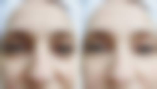 保定驭容医疗美容诊所价格表