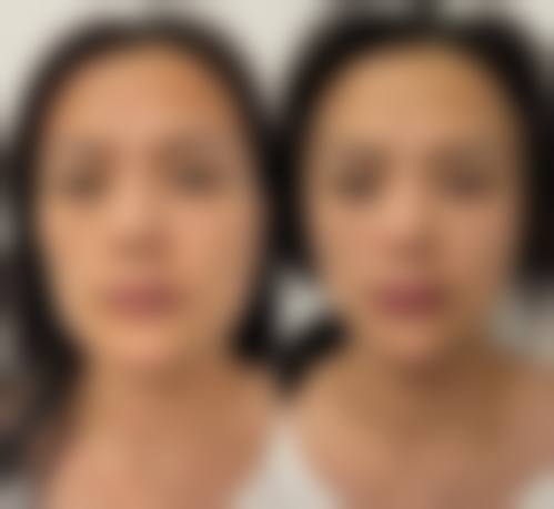 保定驭容医疗美容诊所更擅长什么手术