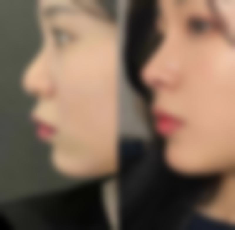 张凯华医生简介口碑如何