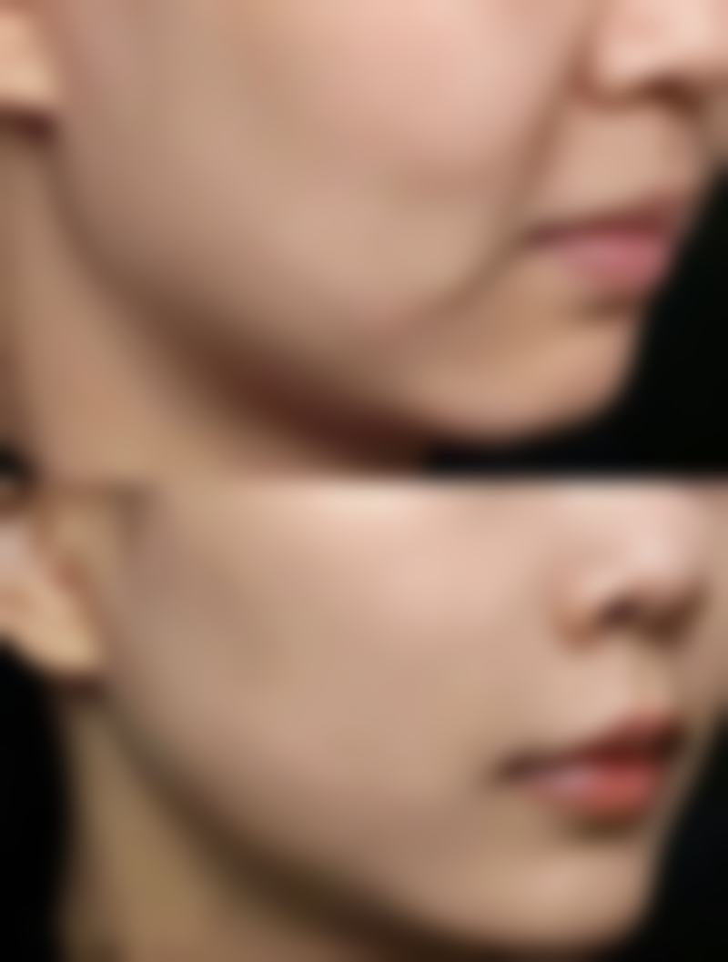 八、沈阳沈河童颜整形医院怎么样——价格表