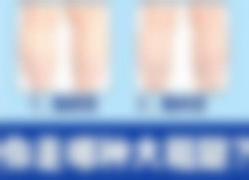 黄庆吉医生做手术价格