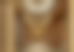 南通英莎医疗美容门诊部李辉提眉眼袋项目审美优势展现