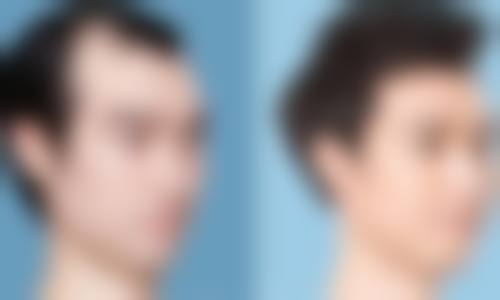 韩国AND整形外科口碑好不好