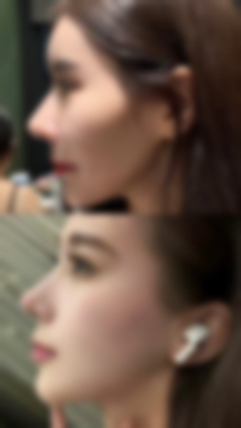 四、沈阳甄美汇整形医院项目特色