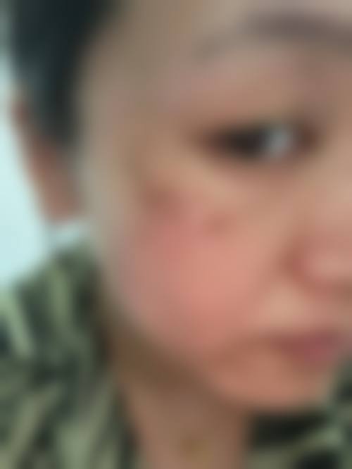 唐山美之源医疗美容诊所可靠吗