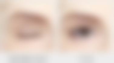 齐淑敏医生项目优势