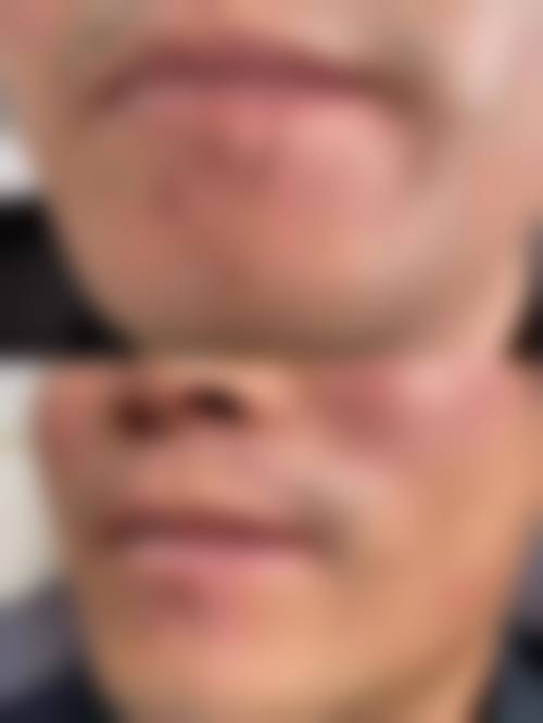 郑州中美医疗美容诊所怎么样，更擅长什么