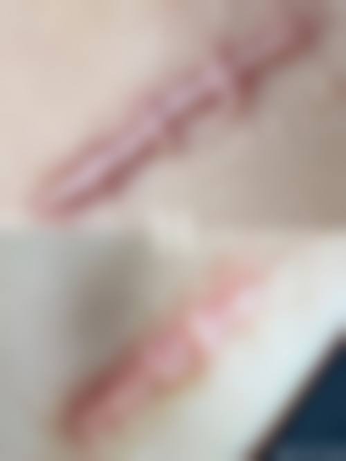 佛山广大医疗美容门诊部顾客实例