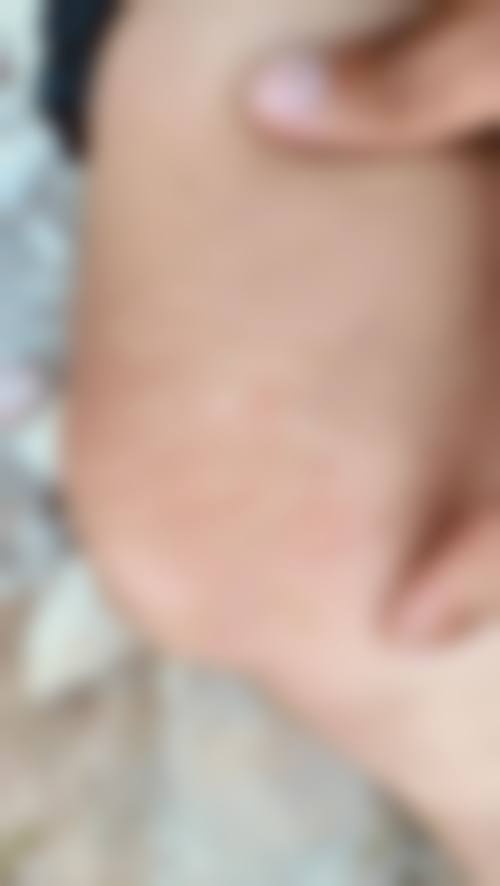 郑州中美医疗美容诊所怎么样，更擅长什么手术