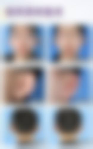 苏州复茂博士整形医院价格表