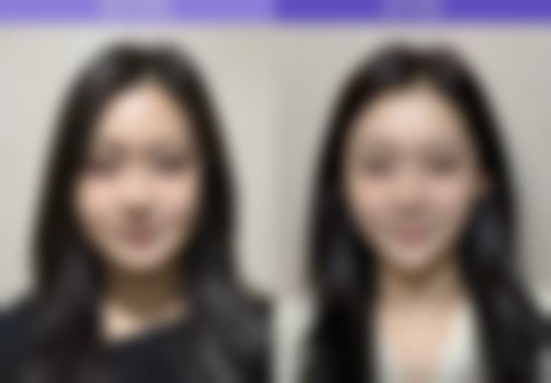 苏州复茂博士整形医院口碑好不好？附真实患者口碑评价