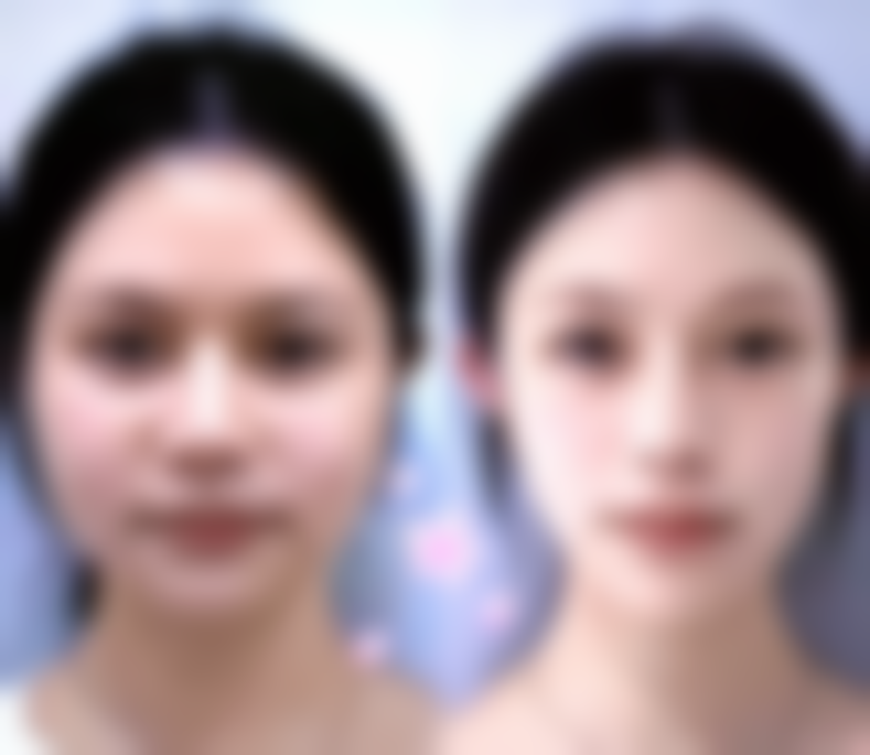 温州小鹿易美医疗美容门诊部顾客实例